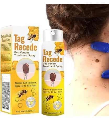 Tag Recede™ - Removedor de Verrugas