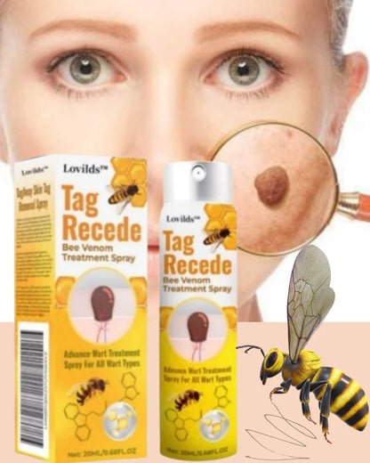 Tag Recede™ - Removedor de Verrugas